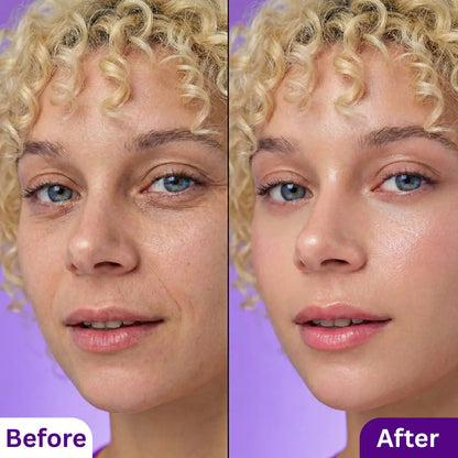 Bakuchiol Plumping Serum