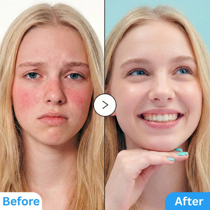 Hyaltoin Flooding Serum