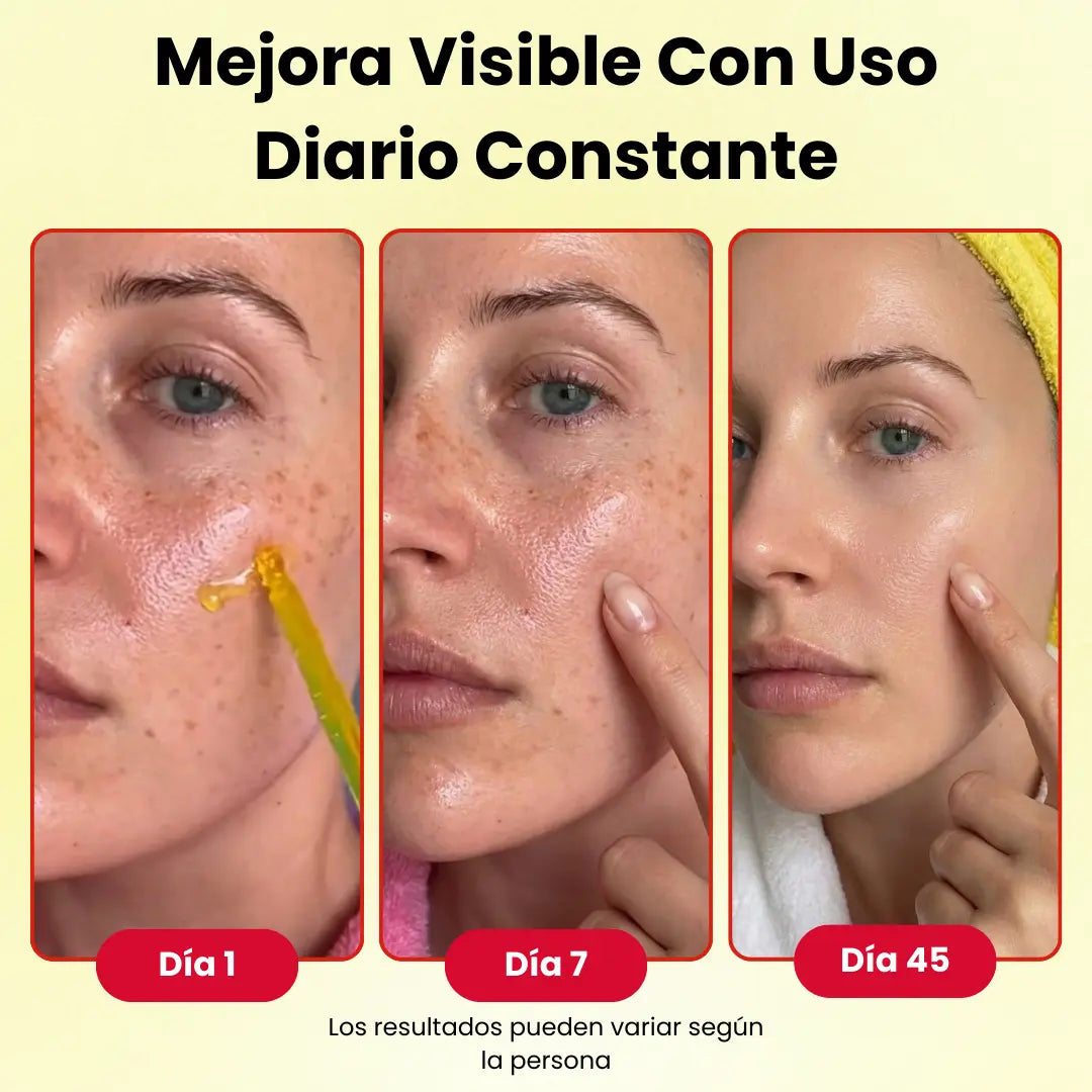 LUMIVIT™ Vitamina C + Niacinamida + Ácido Hialurónico