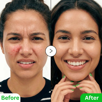 Aloe PDRN Calming Serum